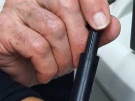 Innovatieve optische technologie uit Israël kan huidkanker ter plaatse vaststellen